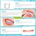 Premium Gimli Provisional Dentures - White Fake Teeth for Men & Women | Top & Bottom Jaw Cosmetic Dental Solution (4 Pairs) - Buy Online on GoSupps.com