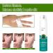 Heal Scar Care Spray | Advanced Formula for All Scar Types | 80g - Enhance Healing & Reduce Visibility - Buy Online on GoSupps.com