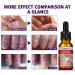 Nail Helper Ingrown Toenail Corrector - Drops for Toenail Correction & Growth Treatment | Fungal Nail & Cuticle Oil Care - Buy Online on GoSupps.com