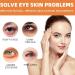 Vitamin C Eye Cream Stick Eye Cream Stick Eye Cream For Dark Circles And Puffy Eyes Hydrating Anti Aging Stick Vitamin C Eye Cream Eyes Cream For Eyebags Eye Stick Under Eye Cream Eye Cream Anti Aging - Buy Online on GoSupps.com