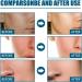 Acne Foam Wash Acne Foaming Wash Mild Daily Facial Cleanser for Deep Pore Cleansing Face Wash Women Mild Cleansing Cleansing Foam Exfoliating Face Wash Foaming Cleanser Facial Wash Cleansing Foam - Buy Online on GoSupps.com