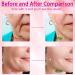 7-in-1 Face and Neck Massager Tool | Red Light Therapy Wand for Skin Care - White | Shop Internationally - Buy Online on GoSupps.com