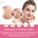 156 PCS Star-Shaped Pimple Patch Set - Hydrocolloid with Tea Tree Oil & Salicylic Acid - Waterproof Suitable for All Skin Types - Pink & Green - Buy Online on GoSupps.com