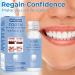 Temporary Tooth Filling Repair Kit - Dental Tooth Filler for Missing or Broken Teeth - Buy Online on GoSupps.com