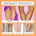 Patch Anti Varices 2x 48pcs patchs Varicose Veins Patch Varices Jambe Soulager Gonflement Varices Traitement Jambe pour Les Jambes limine Les Varices et Les Varicosit s - Buy Online on GoSupps.com