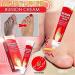 Arching Bunion Relief Cream | Topical Ointment for Arthritis & Joint Pain | Effective Bunion Pain Relief (1PC) - Buy Online on GoSupps.com
