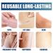 Scar Gel Cream for Surgical Scars C-Section Stretch Marks Acne Burns & Keloids - Effective Treatment for Old & New Scars - Buy Online on GoSupps.com