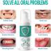 Jorondy Teeth Whitening Mouthwash | 3PCs for Bad Breath & Calculus Removal | Oral Care Solution - Buy Online on GoSupps.com