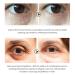 Sonew Snail Essence Eye Cream 20ML - Anti-Wrinkle, Dark Circles & Puffiness Treatment - Buy Online on GoSupps.com