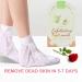 Ultimate Foot Peeling Mask for Cracked Heels | Moisturizing Avocado & Dead Skin Removal - Buy Online on GoSupps.com