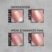 3-in-1 nail care prevent fungal infections anti-onycholysis remedy EMI Antifungal 9 ml  - Buy Online on GoSupps.com