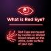 Visine Red Eye Total Comfort Multi-Symptom Eye Drops 0.5 fl. oz - Pack of 4 - Buy Online on GoSupps.com