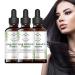 Shelure Hair Growth Oil, Shelure Rosemary Hair Oil Organic, Shelure Hair Regrowth Treatment Oil, Hair Regrowth Extract Oil, Get Luscious Locks With Shelure Hair Regrowth Oil