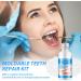 Temporary Tooth Filling Tooth Filling Repair Kit False Teeth for Temporary Tooth Filler Chipped Tooth Repair Kit for Broken & Missing Teeth Replacement (Tooth Repair Kit) - Buy Online on GoSupps.com