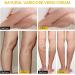 Furzero Varicose Veins Cream - Bee Gift Skin Smoothing & Spider Vein Repair (3PCs) - Shop Internationally - Buy Online on GoSupps.com