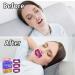 Mouth Tape For Sleeping Quit Mouth Breathing Device Anti Snoring Promotes Nasal Breathing Adhesive Non Woven Fabric Cute Pattern Large Size For Adults 30 Sheets For 30 Days Supply 30 Sheets Forming A New Habit Large Size for Adults - Buy Online on GoSupps.com