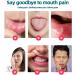 Mouth Ulcer Treatment Spray Oral Ulcer Sprays Ulcer Breath Sprays Canker Relief Spray Canker Sore Treatment Mouth Ulcer Spray Mouth Freshener Spray Breath Spray for Bad Breath Dry Mouth Oral Spray - Buy Online on GoSupps.com