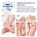 Urea 45% Foot Cream Callus Remover Nourishes Soften for Cracked Heels and Dry Skin Cracked Heel Repair Cream Foot Nourishing Cream for Feet Knees Hand Deep Moisturizing 30ml (1) - Buy Online on GoSupps.com