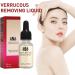 Aibyks 2 Skin Tag Corrector | Natural Mole Remover Cream Natural Skin Tag Removal Mole Corrector for Face Wart and Body Wart - Buy Online on GoSupps.com