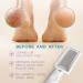Lee Beauty Callus Remover - Professional Foot File Scrubber for Cracked Heels & Dead Skin - Easy to Use Pedicure Tool for Smooth Feet - International Shipping - Buy Online on GoSupps.com