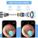 Wireless Ear Wax Removal Endoscope with 14 Ear Pick Tools - 1080P HD Otoscope for iOS & Android Phones/Tablets - Buy Online on GoSupps.com