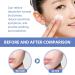 Daily Facial Moisturizer with Ceramides & Hyaluronic Acid - Natural Skin Barrier Repair for Dry & Sensitive Skin - Buy Online on GoSupps.com