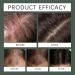 Solution paississante pour cheveux formule douce 30 ml huile de soin du cuir chevelu non grasse huile de croissance des cheveux clairsem s id ale pour les femmes et les hommes apparence plus - Buy Online on GoSupps.com