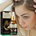 fanelod Hair Growth for Women - Natural Ginger Hair Growth Serums 20ML Biotin Hair Growth - Nourishing Ginger - Buy Online on GoSupps.com