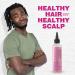 Immetee Scalp Hair Oil - Best Treatment for Dry Itchy Scalp | Anti-Itch Care for Natural & Curly Hair | 190ml (6.42fl oz - Buy Online on GoSupps.com