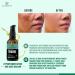 CARAWAY Organic Tamanu Oil - Cold Pressed Natural Moisturizer for Skin Hair & Face - Treats Hyperpigmentation Acne Scars Eczema & Psoriasis - 1.7 Fl oz (50 ml - Buy Online on GoSupps.com