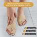 Jinlingnb Ballenkorkerne - Orthopedic Big Toe Spreader for Hallux Valgus Correction & Pain Relief | Non-Surgical Solution - Buy Online on GoSupps.com