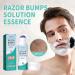 Botiniv Solution for Ingrown Hair Razor Cap 100 ml with Ball Bottle Aftershave Repair without Razor Bumps or Ingrown Hair - Buy Online on GoSupps.com