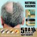 Ginger Hair Growth Ointment - Hair Regrowth Serum for Hair Loss Treatment - Scalp Massage Essence Cream - 30g/1 OZ Sample - Buy Online on GoSupps.com