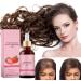 Strawberry Mint Growth Oil Strawberry Mint Hair Growth Oil Natural Rosemary Hair Essential Oil Strawberry Oil for Hair Growth Strawberry Essential Oil Rosemary Oil for Hair Growth & Skin Care 1 - Buy Online on GoSupps.com