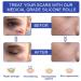Transparent Silicone Scar Tape Sheet - Wide Application, Breathable & Comfortable - Buy Online on GoSupps.com