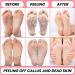 Korean Foot Peeling Masks 2PCS - KN FLAX - Repair Dead Skin Cells & Cracked Heels - Feet Peeling Mask with Hemp Oil & Kombucha Extract - Exfoliating & Hydrating - 2 Count - Buy Online on GoSupps.com