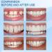 Tooth Repair Granules & Temporary Teeth Replacement Kit | Moldable Fake Teeth & Thermal Beads | Reusable Solution (10ml-1PCS) - International Shipping Available - Buy Online on GoSupps.com