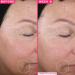 Farmacy 1% Vitamin A Anti Wrinkle Retinol Serum - Resurfacing Formula with Upcycled Ingredients - 1 Fl Oz - Buy Online on GoSupps.com