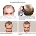 Growth Hair Oil Spray - Repair Follicles & Strengthen Roots | DHT Blocker | Nourishing 30ml - Buy Online on GoSupps.com