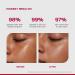/PHD/ 10% Vitamin C Brightening Serum | For Glowing skin Oily skin Dry skin | Dark Spots & Uneven Tone Treatment | Face serum for Women & Men | Formulated with Global Dermatologists | 30ml - Buy Online on GoSupps.com