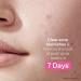 StriVectin Multi Action Clear Acne Treatment Set | 30-Day Trial Kit for Clearer Smoother Skin | Blemish Control & Breakout Defense - Buy Online on GoSupps.com