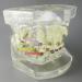 Shop Dental Malocclusion Orthodontic Treatment Model - Metal Brackets & Colorful Ties | M3005 - International Shipping Available - Buy Online on GoSupps.com