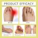 Bee Venom Bunion Relief Cream Bunion Relief Rub Bunion Relief Balm Bunion Cream Bunion Gout Cream Toe and Knee Joint Cream Healing Cream for Aching Bunions & Dry Cracked Skin(1pcs) - Buy Online on GoSupps.com