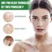 Vitiligo Treatment Cream | Natural White Spot Remover | Leukoplakia Relief | 2PCS - Buy Online on GoSupps.com