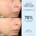 NuFACE TRINITY+ and Effective Lip & Eye Attachment - Buy Online on GoSupps.com