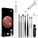 ACWOO Ear Wax Remover - 1296P HD Wireless Ear Wax Removal Kit with Camera - Visual Otoscope Ear Cleaner for Adults, Kids & Pets - Buy Online on GoSupps.com