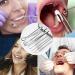 Truein 8-Piece Stainless Steel Tartar Remover Set | Professional Dental Care Kit for Tartar & Tooth Cleaning - Buy Online on GoSupps.com