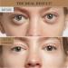 Retinol Eye Cream Instant Lift Plus Dark Circles Instant Lift Plus Poche Yeux Hydrating & Moisturizing Eye Cream Lightens Lines And Dark Circles Instantly Removes Bags Dark Circles - Buy Online on GoSupps.com