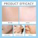 Gla-mory Micro Infosion System for Lips Gla-mory Micro System for Face Facial System with Serum Hyaluronic Acid Serum Hyaluronic Acid Serum for Face Hydrating Serum Collagen Serum for Face 10ml - Buy Online on GoSupps.com