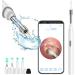 QDCFY OTOSKOK Endoscopic camera tool for removing ear wax wireless otoscope with LED light for iPhone iPad and Android smartphone (black) white